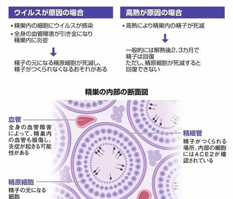 【朝日新聞】コロナに感染後、精子が減る報告が海外で相次ぐ…ウイルスの侵入か高熱か