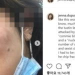 「北朝鮮売春婦などと３時間暴言・暴行」…１０代韓国系女性に憎悪犯罪の黒人を逮捕