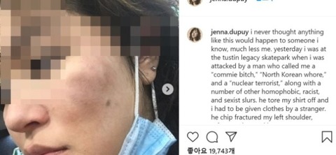 「北朝鮮売春婦などと３時間暴言・暴行」…１０代韓国系女性に憎悪犯罪の黒人を逮捕