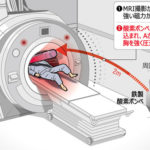 【韓国】MRIが磁力で酸素ボンベを吸い込む…検査中の患者が挟まれ死亡　／金海