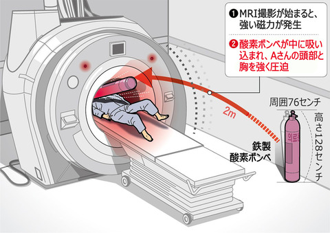 【韓国】MRIが磁力で酸素ボンベを吸い込む…検査中の患者が挟まれ死亡　／金海