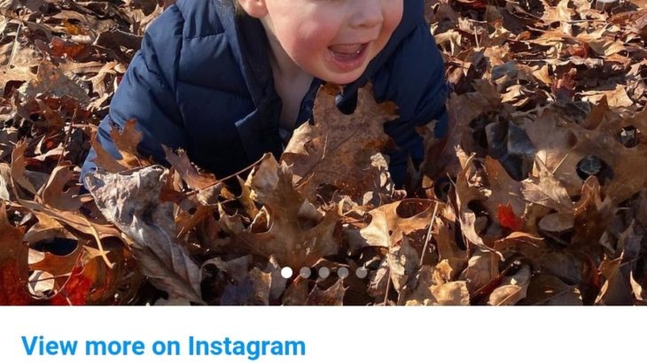 【画像】1歳の赤ちゃん「櫛でとかせない頭髪症候群」という世界でも珍しい病気にかかりスーパーサイヤ人みたいになる