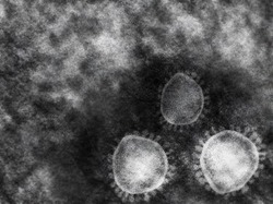 【絶望】コロナ 、岸田がワクチン普及サボったせいで過去最大の感染爆発が起きる