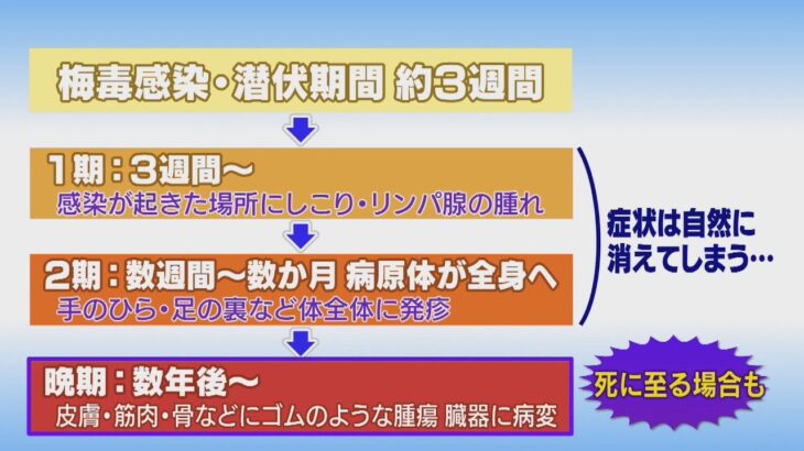 【注目】いったい何が起こっているの⁉『梅毒感染者』初の1万人超え・・・