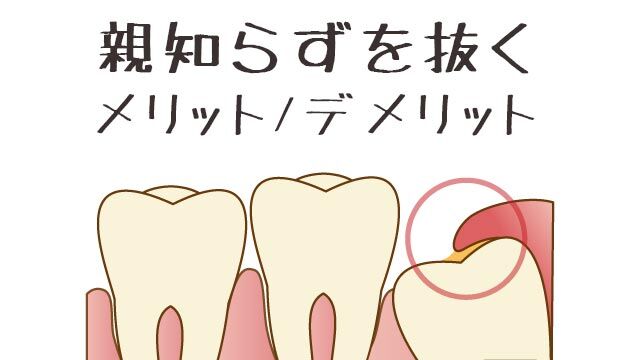 「親知らず」は抜くべき、抜かなくてもいい？ 歯科医芸人の見解「デメリットの方が圧倒的に多い」