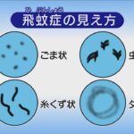 衝撃まるで目の中に浮かんでいるSNS上で大反響の飛蚊症キーホルダーとは