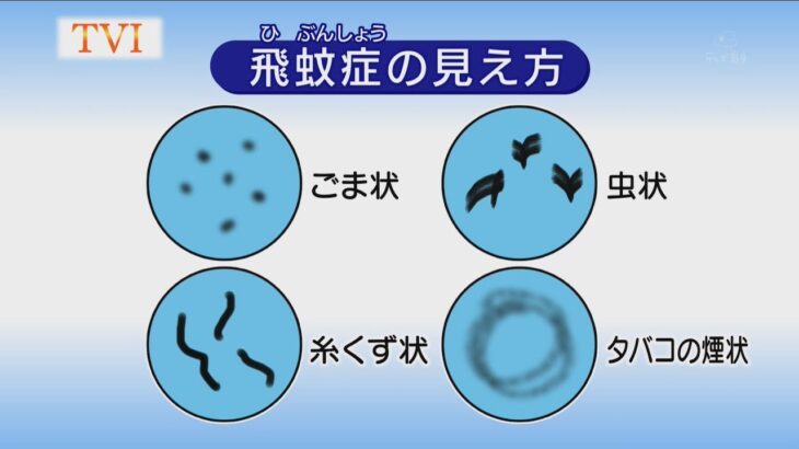 衝撃まるで目の中に浮かんでいるSNS上で大反響の飛蚊症キーホルダーとは