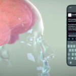 イーロン・マスクの会社、人間の脳にチップを埋め込む手術を初めておこなったと発表