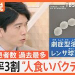 【必見】過去最多の致死率3割‼ 人食いバクテリアの恐怖に隠された真実とは？