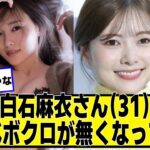 【話題】元乃木坂46白石麻衣、顔のほくろ消失‼ 熱愛報道との関連は？