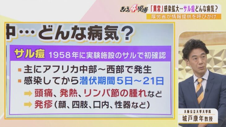 【国際】アフリカでサル痘（エムポックス）感染拡大、WHOが緊急委開催へ‼