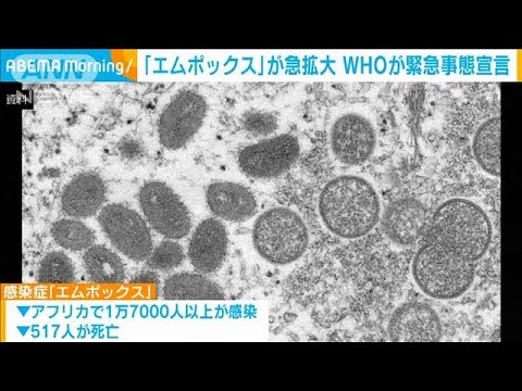 【必見】世界保健機関が警告するエムポックス（サル痘）の国際的なリスクとは？