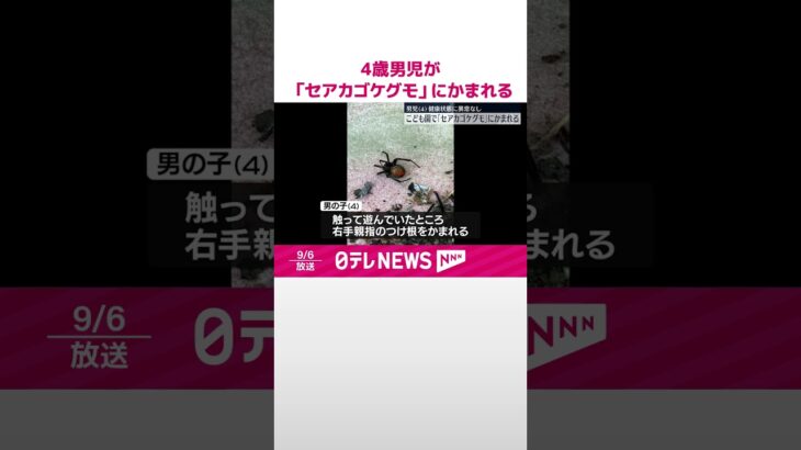 【驚愕】香川・坂出市でセアカゴケグモに刺された男児、病院で検査の結果は？