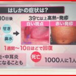 【必見】埼玉県における麻疹（はしか）感染の実態と健康への影響とは？