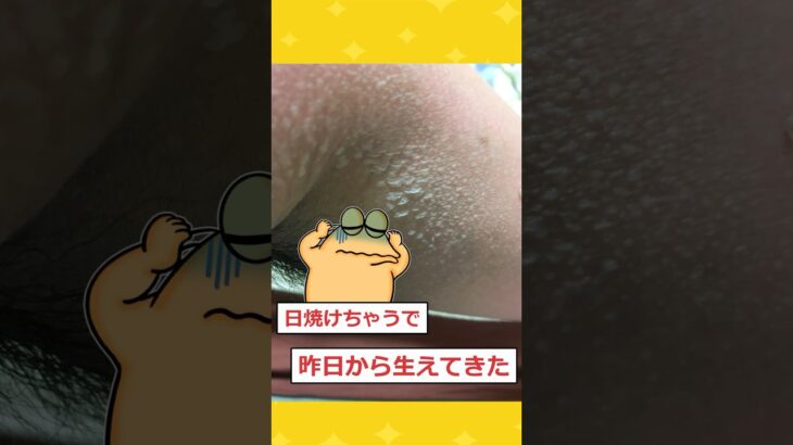 【マジかよ】ワイの肌から突然ウロコが生えてきたんだがwwww