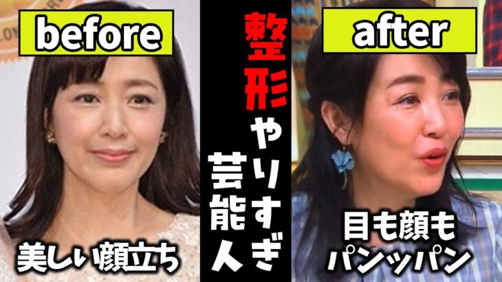 【仰天】違和感しかない…整形に取り憑かれた芸能人