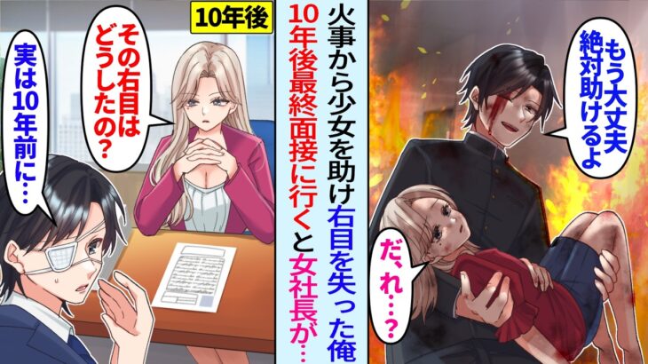【動画】火事から少女を救い右目失った俺に10年後、転職活動中に美人女社長「あなた…その目どうしたの?」質問されたが…