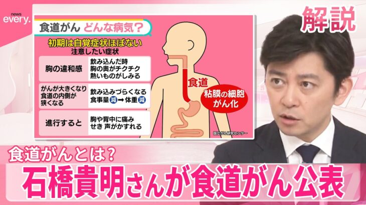 【話題】石橋貴明のがん克服を応援！帝京魂とは？