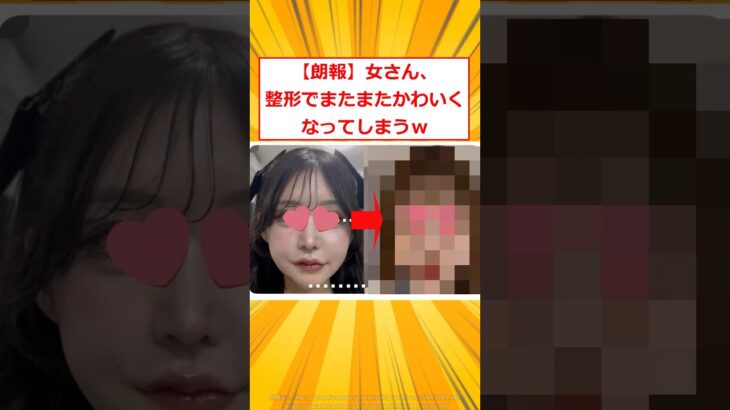 【驚愕】女さん、整形でまたまたかわいくなってしまうw