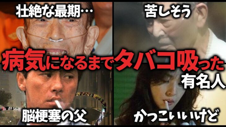 【驚愕】壮絶…タバコを吸いすぎて病気になった芸能人