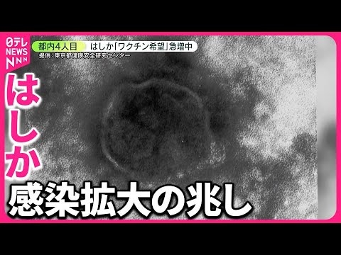【必見】20代男性がはしかに感染！その経緯と症状とは？
