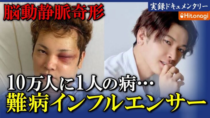 【話題】39歳俳優・間瀬翔太の難病との闘いと救急搬送の真相とは？