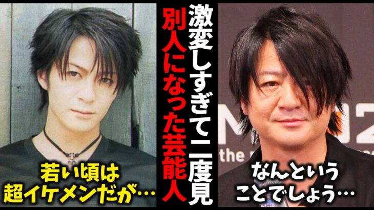 【驚愕】もはや誰かわからない…激変しすぎて二度見レベルの芸能人まとめ