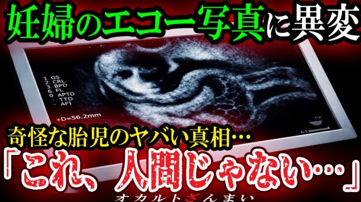 【動画】[閲覧注意]エコー写真に写る奇怪な胎児のヤバすぎる真相…子どもにまつわる心霊怪奇事件
