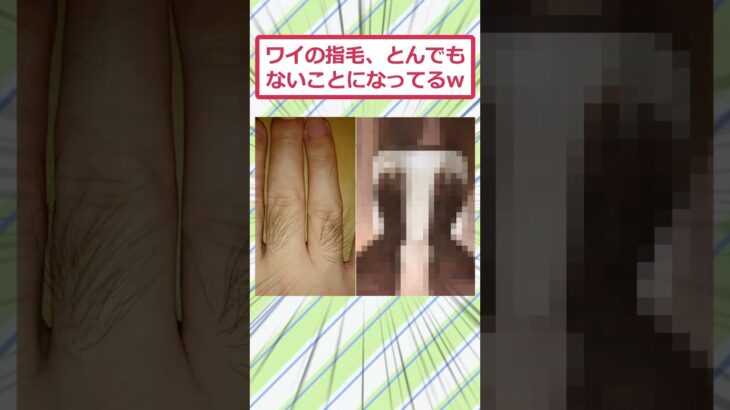 【衝撃】ワイの指毛、とんでもないことになってるww